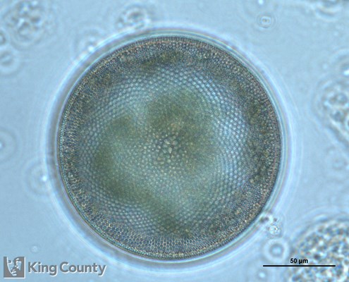 Photo of Coscinodiscus spp.